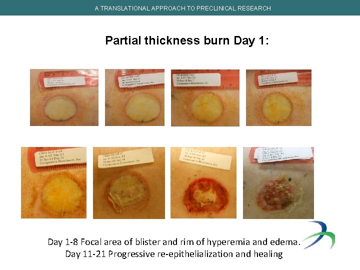 A TRANSLATIONAL APPROACH TO PRECLINICAL RESEARCH Partial thickness burn Day 1: Day 1 -8