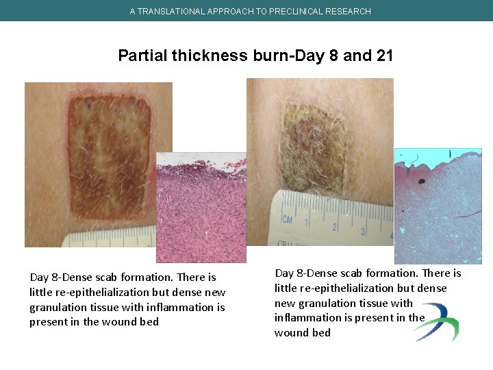 A TRANSLATIONAL APPROACH TO PRECLINICAL RESEARCH Partial thickness burn-Day 8 and 21 Day 8