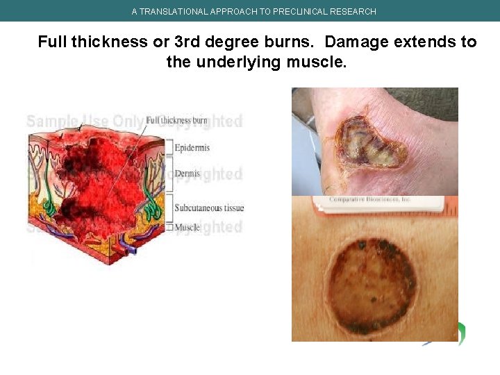A TRANSLATIONAL APPROACH TO PRECLINICAL RESEARCH Full thickness or 3 rd degree burns. Damage