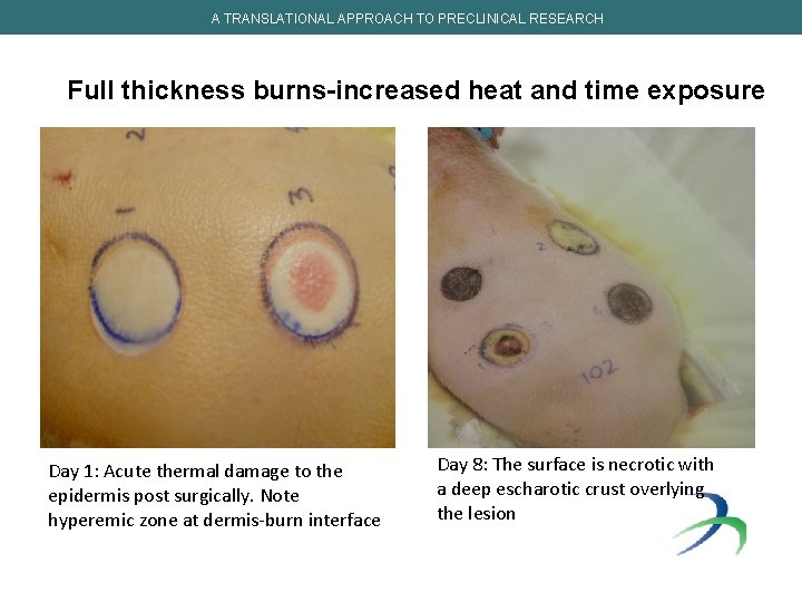 A TRANSLATIONAL APPROACH TO PRECLINICAL RESEARCH Full thickness burns-increased heat and time exposure Day