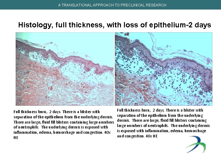 A TRANSLATIONAL APPROACH TO PRECLINICAL RESEARCH Histology, full thickness, with loss of epithelium-2 days