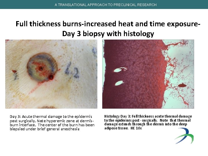 A TRANSLATIONAL APPROACH TO PRECLINICAL RESEARCH Full thickness burns-increased heat and time exposure. Day