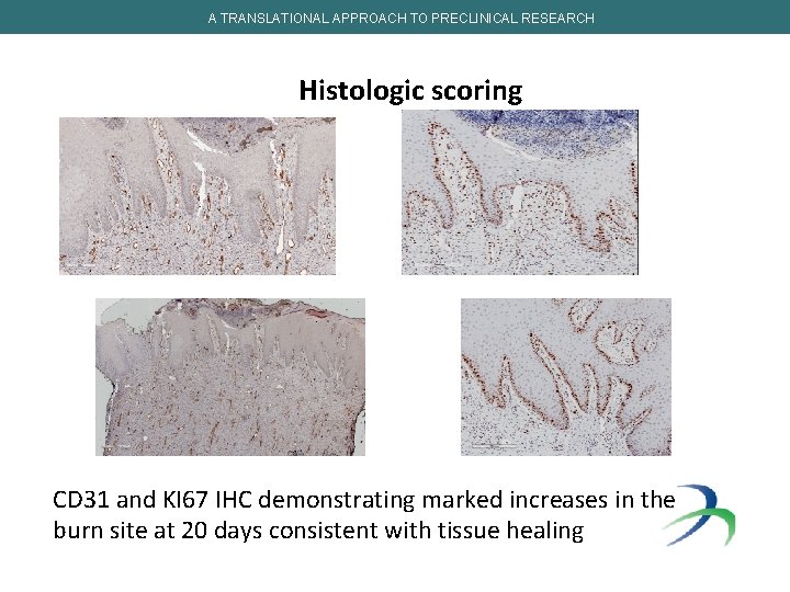 A TRANSLATIONAL APPROACH TO PRECLINICAL RESEARCH Histologic scoring CD 31 and KI 67 IHC