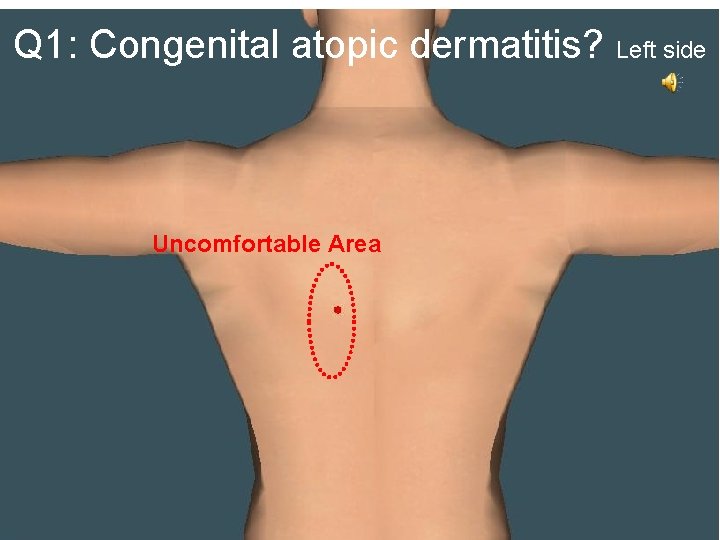 Q 1: Congenital atopic dermatitis? Left side Uncomfortable Area 