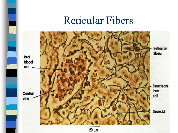 Reticular Fibers 