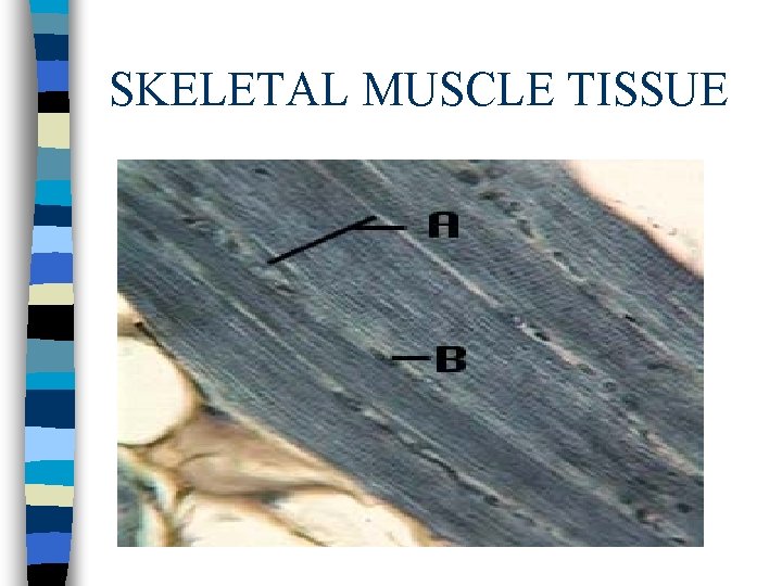 SKELETAL MUSCLE TISSUE 