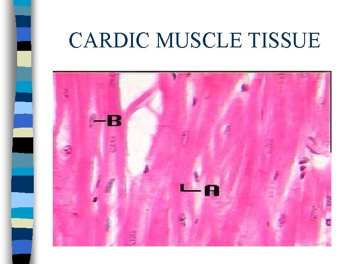 CARDIC MUSCLE TISSUE 