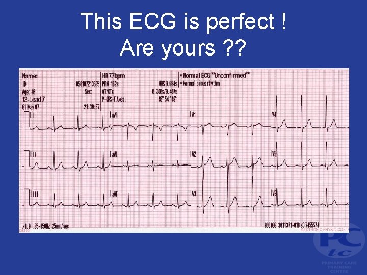 This ECG is perfect ! Are yours ? ? 