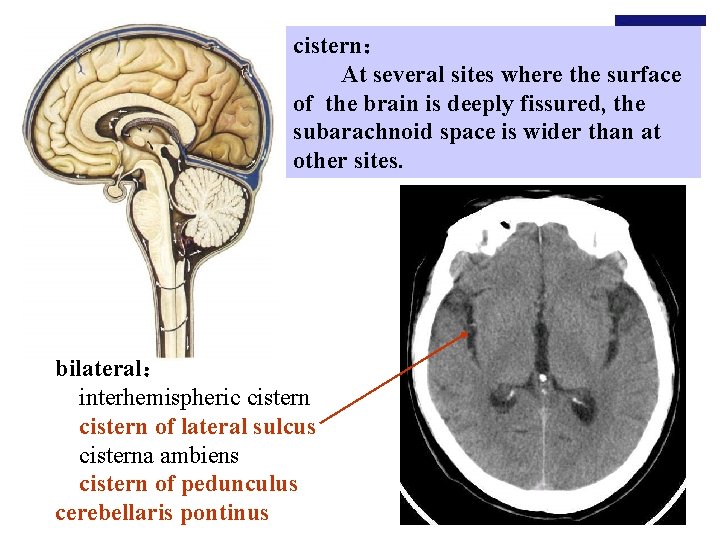 cistern： At several sites where the surface of the brain is deeply fissured, the
