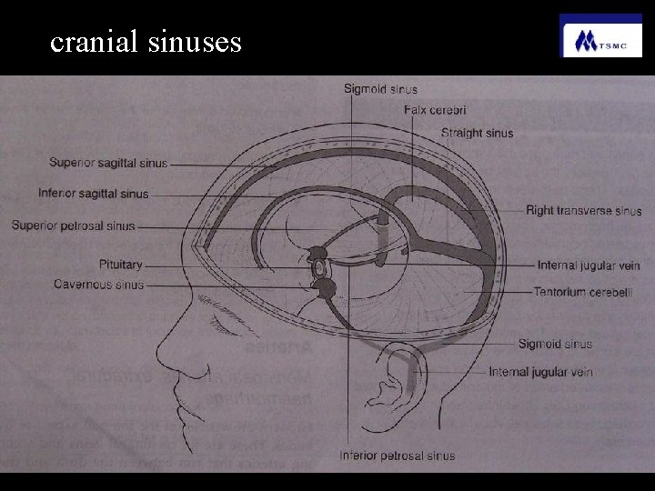 cranial sinuses 