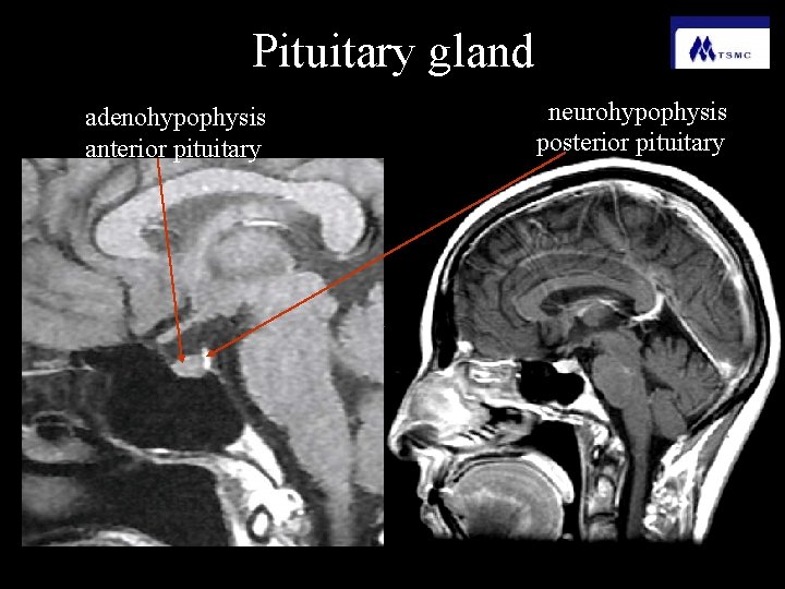 Pituitary gland adenohypophysis anterior pituitary neurohypophysis posterior pituitary 