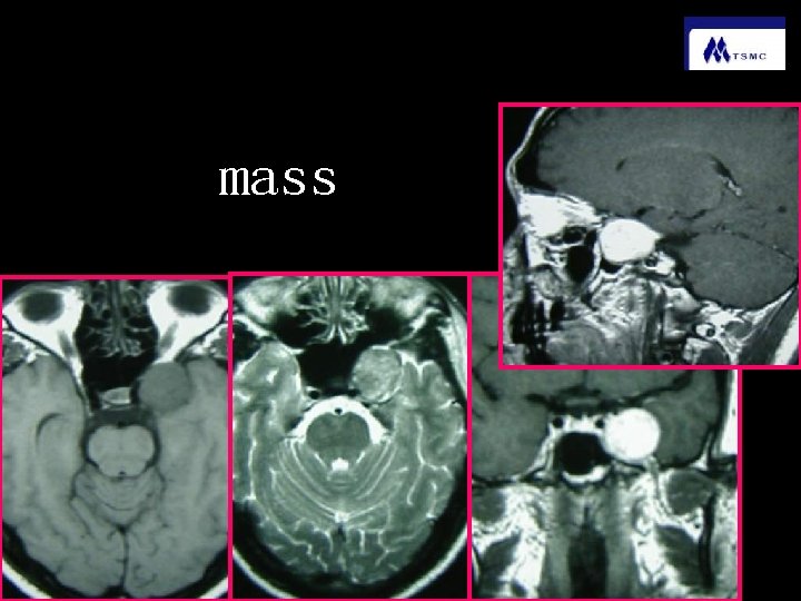 mass 