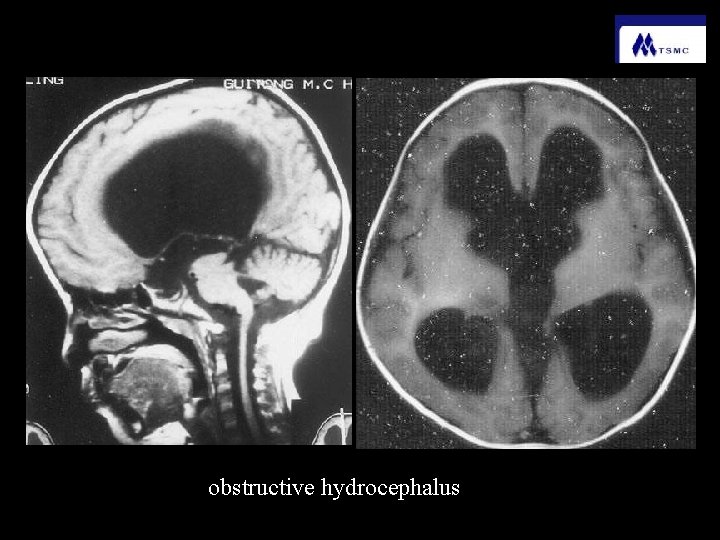 Central nervous system Guanghui Yu Radiology college Central