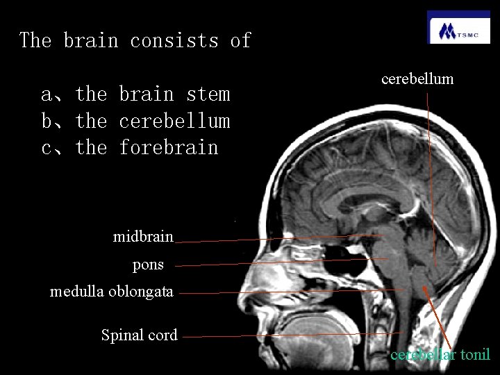 The brain consists of a、the brain stem b、the cerebellum c、the forebrain cerebellum midbrain pons