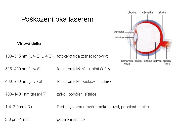 Poškození oka laserem Vlnová délka 180– 315 nm (UV-B, UV-C) fotokeratitida (zánět rohovky) 315–