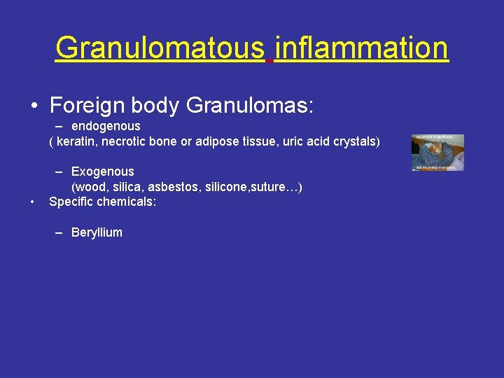 Granulomatous inflammation • Foreign body Granulomas: – endogenous ( keratin, necrotic bone or adipose