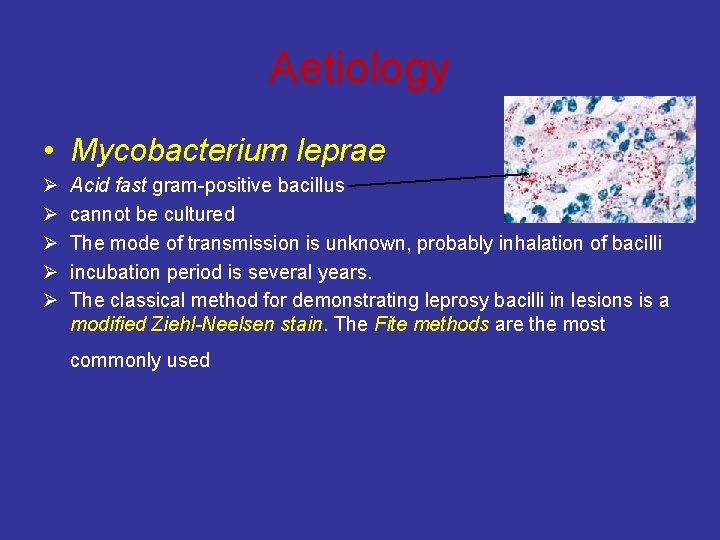 Aetiology • Mycobacterium leprae Ø Ø Ø Acid fast gram-positive bacillus cannot be cultured