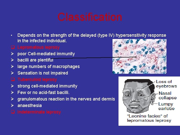 Classification • q Ø Ø Ø Ø q Depends on the strength of the