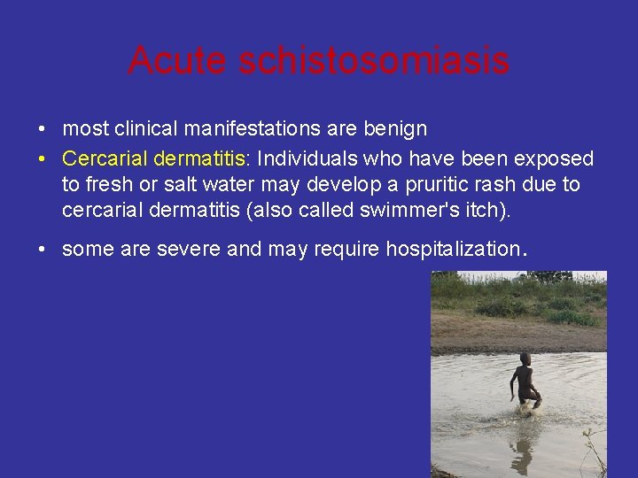 Acute schistosomiasis • most clinical manifestations are benign • Cercarial dermatitis: Individuals who have