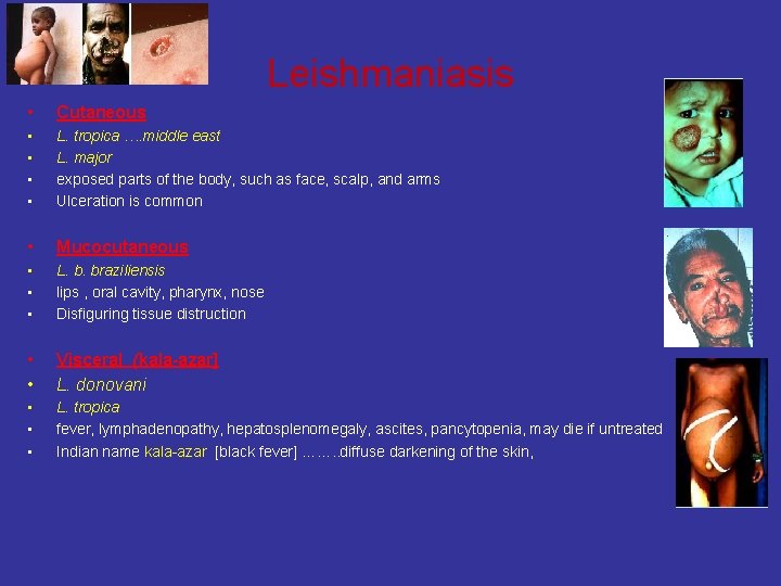 Leishmaniasis • Cutaneous • • L. tropica …. middle east L. major exposed parts