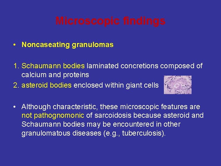 Microscopic findings • Noncaseating granulomas 1. Schaumann bodies laminated concretions composed of calcium and