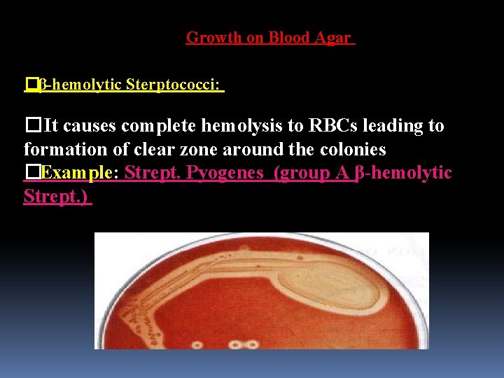 Growth on Blood Agar �β-hemolytic Sterptococci: �It causes complete hemolysis to RBCs leading to