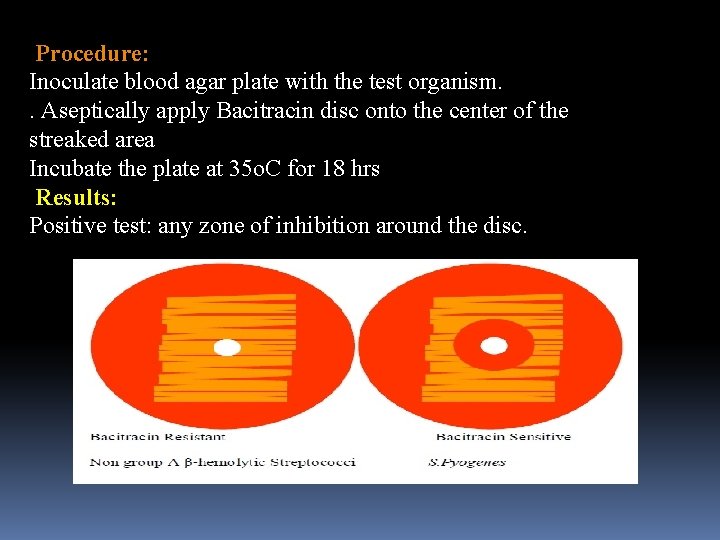 Procedure: Inoculate blood agar plate with the test organism. . Aseptically apply Bacitracin disc