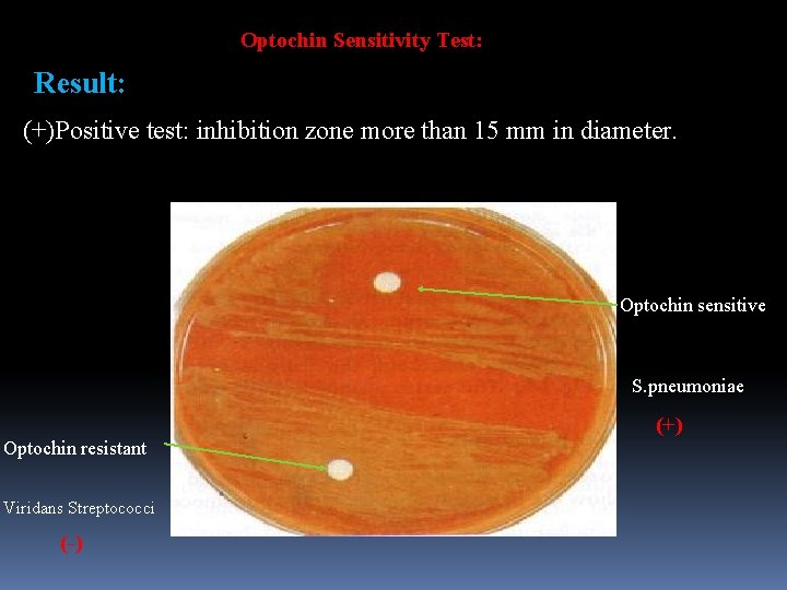 Optochin Sensitivity Test: Result: (+)Positive test: inhibition zone more than 15 mm in diameter.