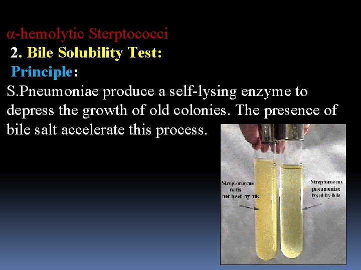 α-hemolytic Sterptococci 2. Bile Solubility Test: Principle: S. Pneumoniae produce a self-lysing enzyme to