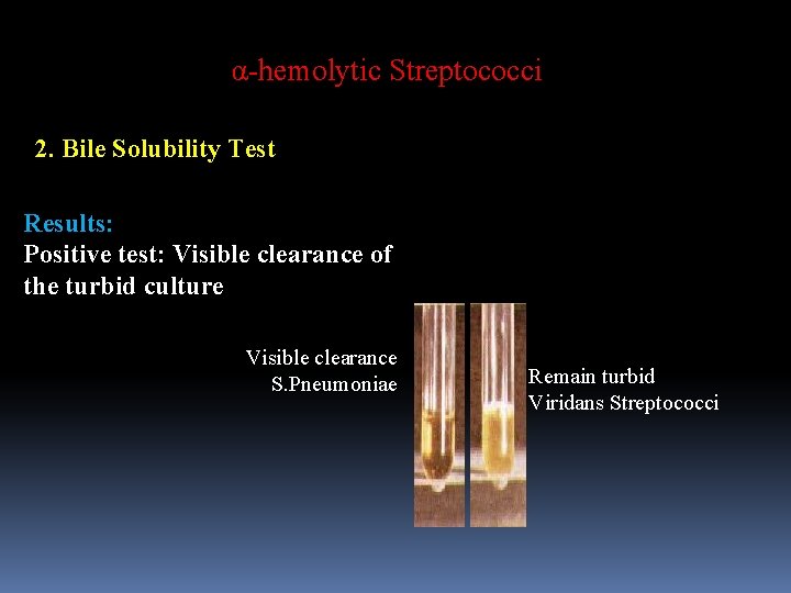 α-hemolytic Streptococci 2. Bile Solubility Test Results: Positive test: Visible clearance of the turbid