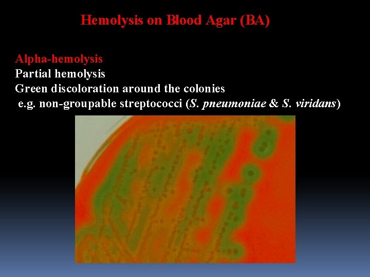 Hemolysis on Blood Agar (BA) Alpha-hemolysis Partial hemolysis Green discoloration around the colonies e.