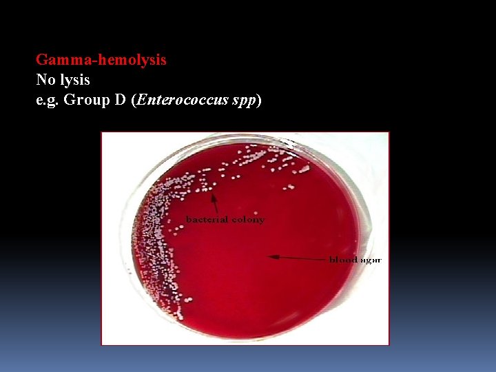 Gamma-hemolysis No lysis e. g. Group D (Enterococcus spp) 