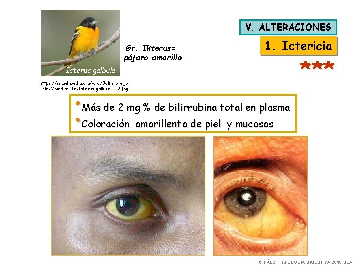 V. ALTERACIONES Gr. Ikterus= pájaro amarillo 1. Ictericia *** Icterus galbula https: //en. wikipedia.