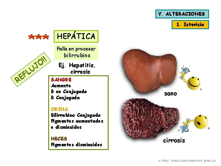 V. ALTERACIONES 1. Ictericia *** ! ! O J U L F E R V. ALTERACIONES 1. Ictericia *** ! ! O J U L F E R