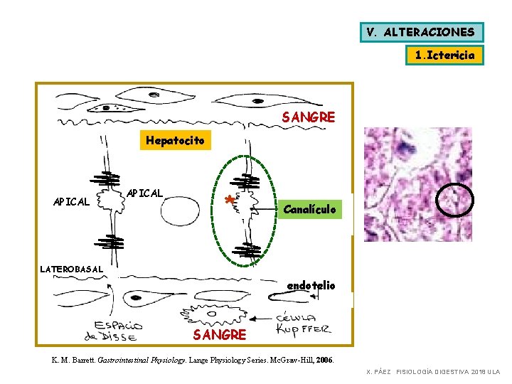 V. ALTERACIONES 1. Ictericia SANGRE Hepatocito APICAL * Canalículo LATEROBASAL endotelio SANGRE K. M.