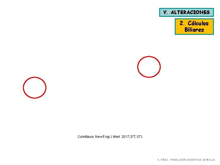 V. ALTERACIONES 2. Cálculos Biliares Colelitiasis. New Engl J Med 2017; 371 X. PÁEZ