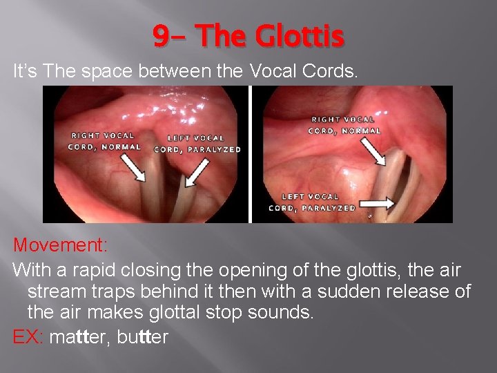 9 - The Glottis It’s The space between the Vocal Cords. Movement: With a