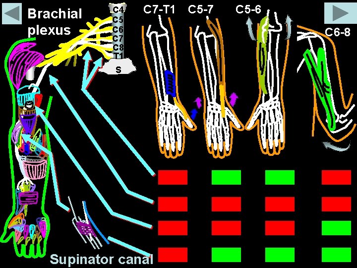 Brachial plexus C 4 C 5 C 6 C 7 C 8 T 1 Brachial plexus C 4 C 5 C 6 C 7 C 8 T 1