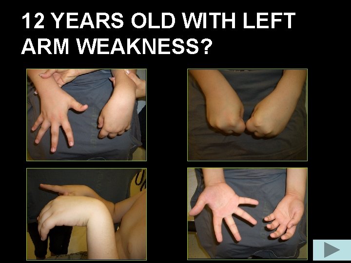 12 YEARS OLD WITH LEFT ARM WEAKNESS? 12 YEARS OLD WITH LEFT ARM WEAKNESS?