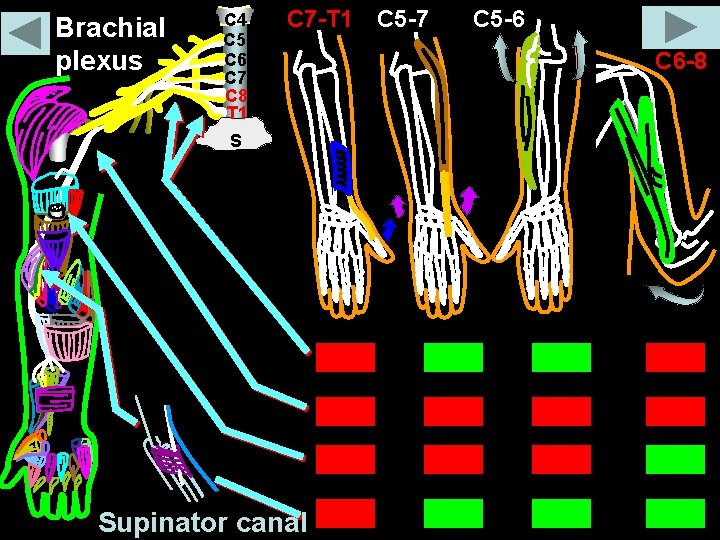 Brachial plexus C 4 C 5 C 6 C 7 C 8 T 1 Brachial plexus C 4 C 5 C 6 C 7 C 8 T 1