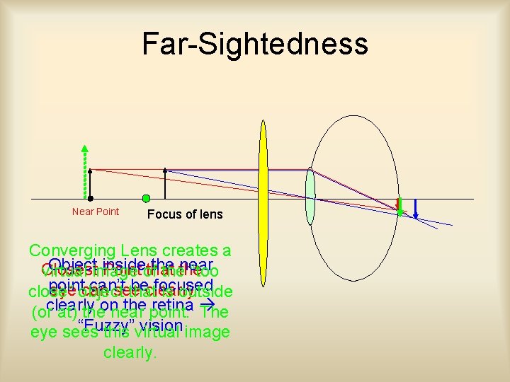 Far-Sightedness Near Point Focus of lens Converging Lens creates a Objectimage inside the near