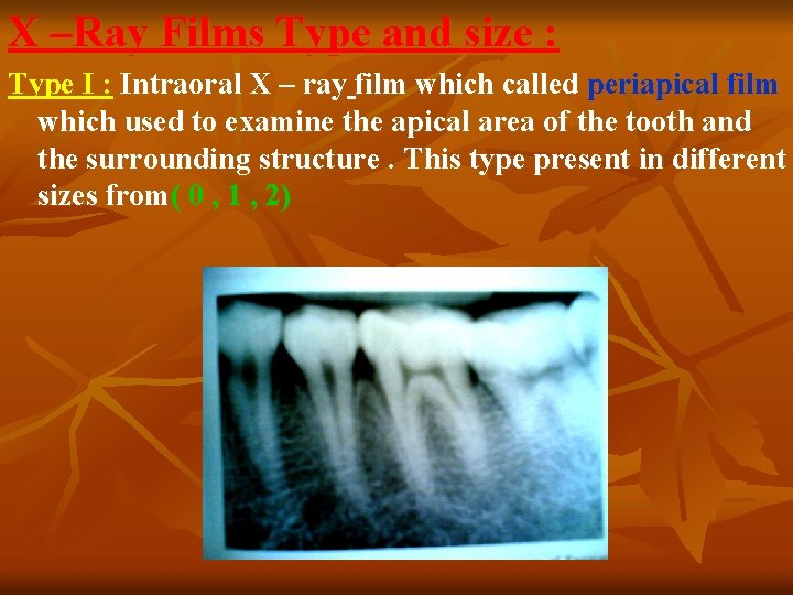 X –Ray Films Type and size : Type I : Intraoral X – ray
