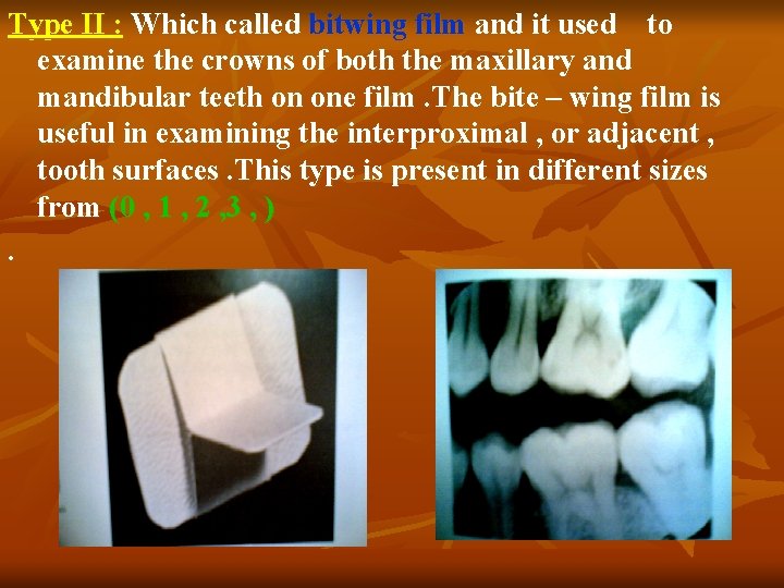 Type II : Which called bitwing film and it used to examine the crowns