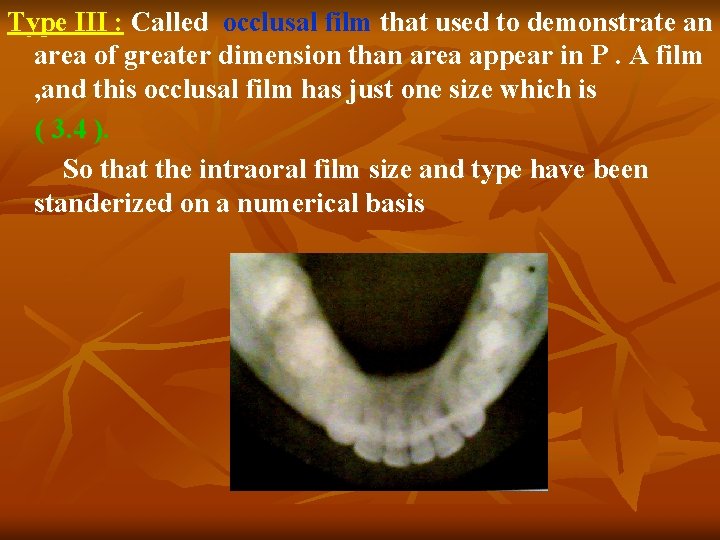 Type III : Called occlusal film that used to demonstrate an area of greater