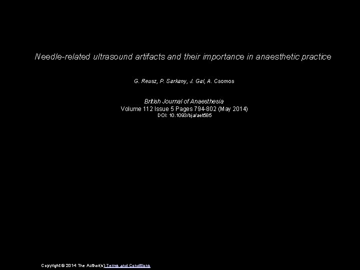 Needle-related ultrasound artifacts and their importance in anaesthetic practice G. Reusz, P. Sarkany, J.