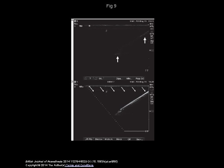 Fig 9 British Journal of Anaesthesia 2014 112794 -802 DOI: (10. 1093/bja/aet 585) Copyright