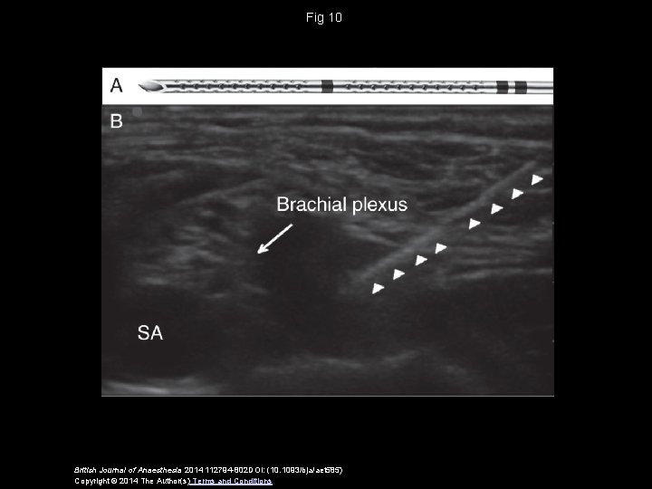 Fig 10 British Journal of Anaesthesia 2014 112794 -802 DOI: (10. 1093/bja/aet 585) Copyright