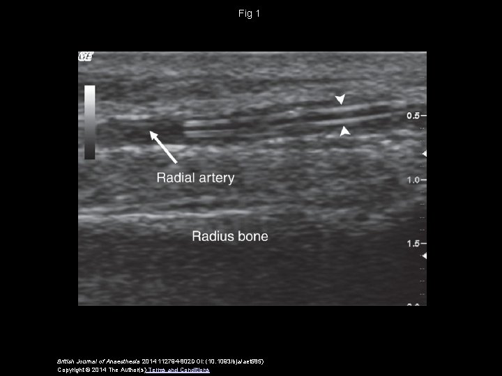 Fig 1 British Journal of Anaesthesia 2014 112794 -802 DOI: (10. 1093/bja/aet 585) Copyright