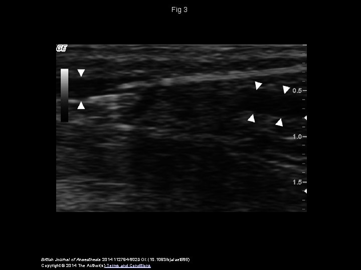 Fig 3 British Journal of Anaesthesia 2014 112794 -802 DOI: (10. 1093/bja/aet 585) Copyright