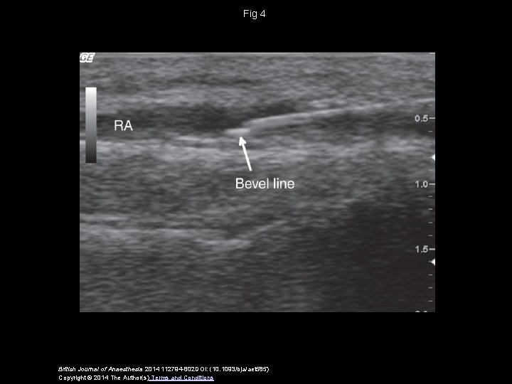 Fig 4 British Journal of Anaesthesia 2014 112794 -802 DOI: (10. 1093/bja/aet 585) Copyright